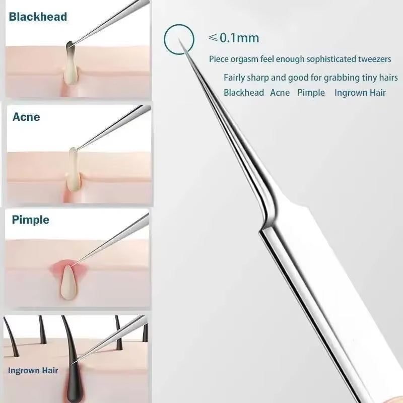 Beautybosss PRO SKIN 11-delige Set – Voor een zuivere huid zonder imperfecties