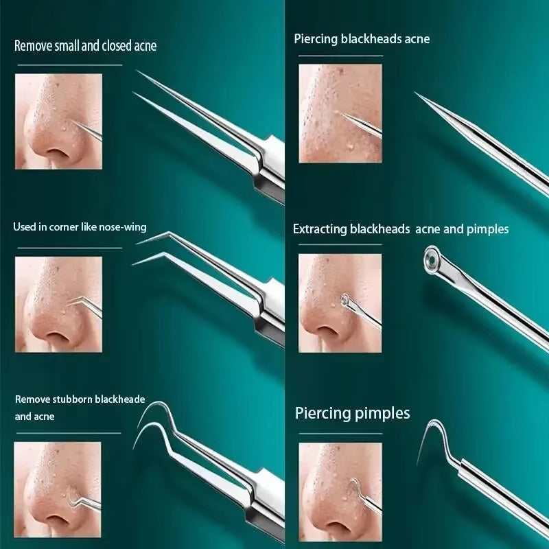 Beautybosss PRO SKIN 11-delige Set – Voor een zuivere huid zonder imperfecties